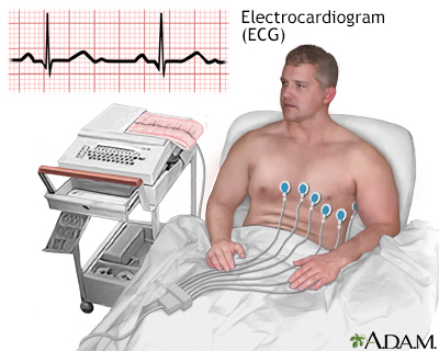 Diagnosis Code For Family History Of Coronary Artery Disease