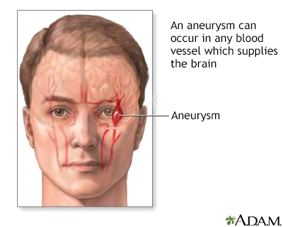 Ruptured Testicle Symptoms