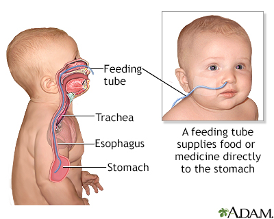 Cantor Tube Picture