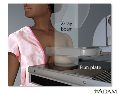 Angles Home Phone Service on Mammogram  Imagepage Information