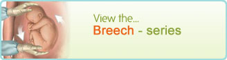 Breech - serie