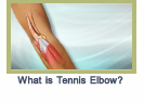 tenniselbow