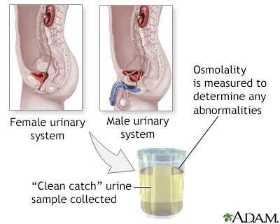 Osmolality test