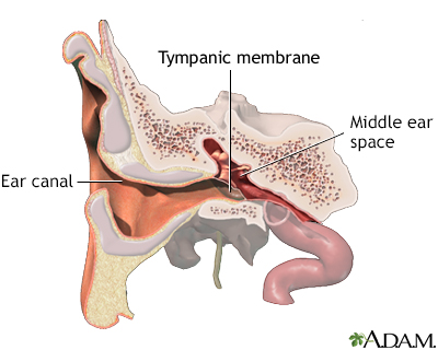 Ear tube insertion - series - Normal anatomy