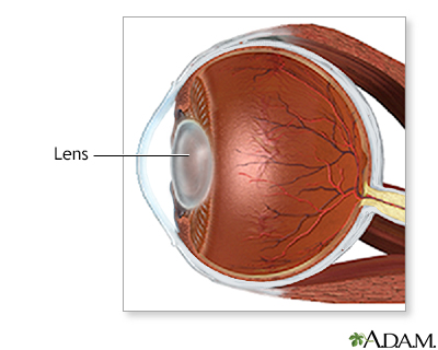 Cataract surgery - series - Normal anatomy