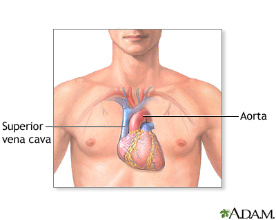 Normal anatomy