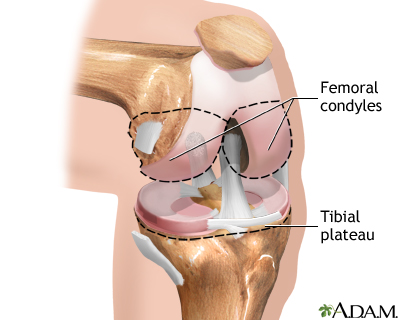 Knee joint replacement - Normal anatomy