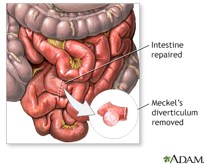 Procedure