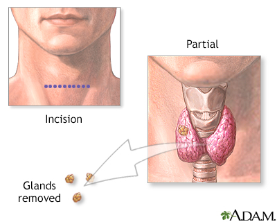 Procedure