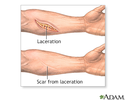 Scar revision - series