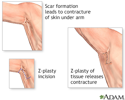 Procedure, Part 1