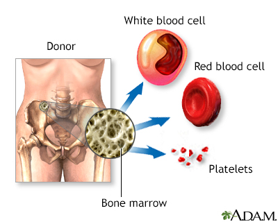 Normal anatomy