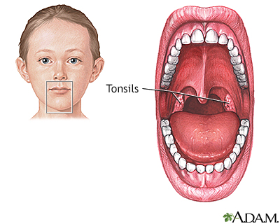 Normal anatomy