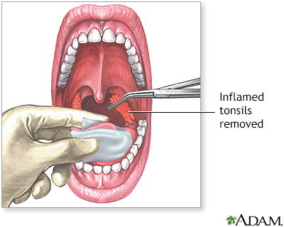 Procedure