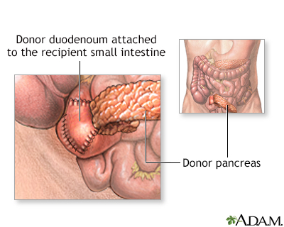 Procedure, part 1