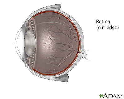 Retinal detachment repair - normal anatomy