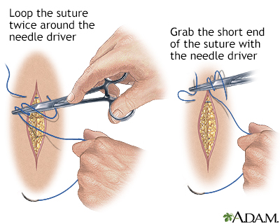 Sewing a wound closed, part 5