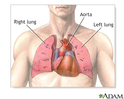 Normal anatomy