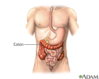 The colon or large intestine - Normal anatomy