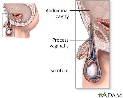 Normal anatomy