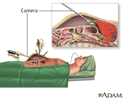 Procedure, part 1