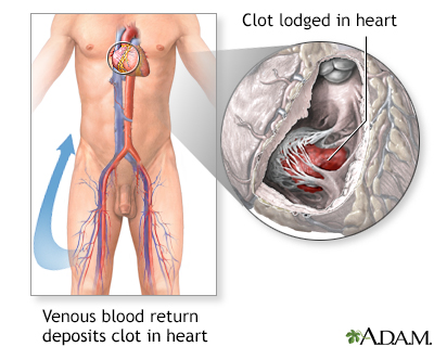 Procedure, part 1