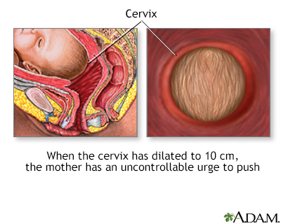 Emergency Childbirth