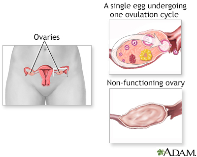 Infertility Factors