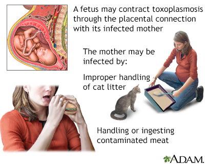 Taxoplasmosis