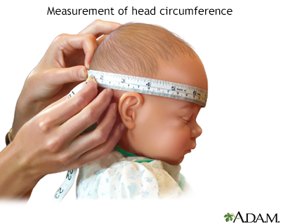 Head circumference