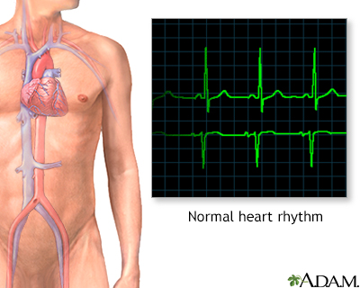 ECG