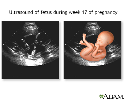 17 week ultrasound