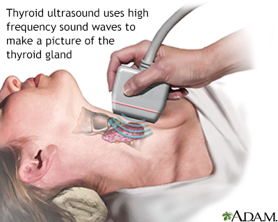 Thyroid ultrasound