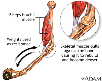 Bone-building exercise