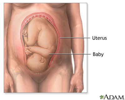 C-Section - Series