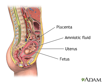 Amniocentesis