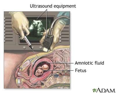 Procedure, part 1