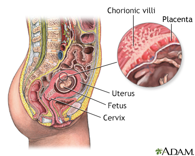 Chorionic Villus Sampling