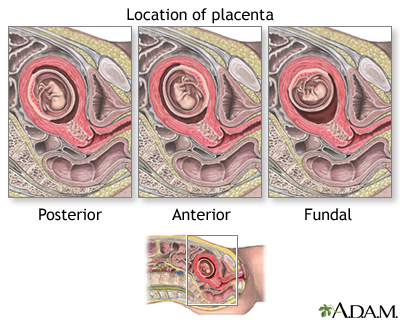 Chorionic Villus Sampling