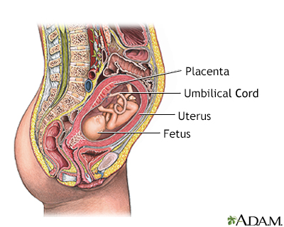 Percutaneous umbilical cord blood sampling - series