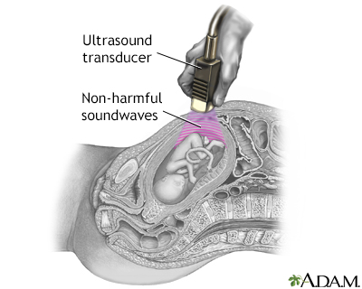 Ultrasound