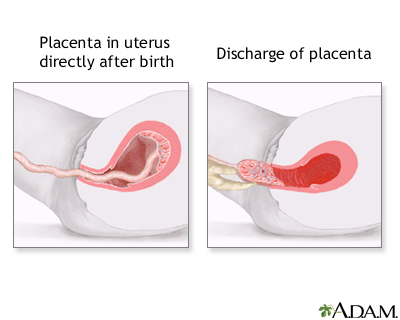 Procedure, part 7