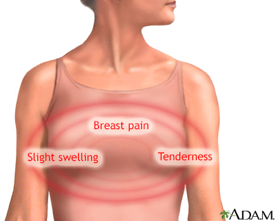 Information for people experiencing breast pain :: East Lancashire