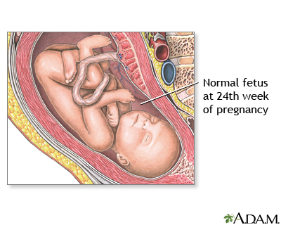 24 Week Old Fetus