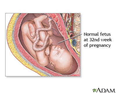 32 Week Old Fetus