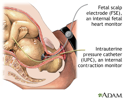 Extraction Procedures