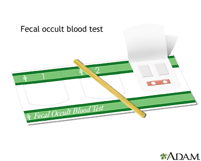 Fecal occult blood test