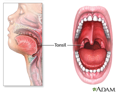 Tonsils