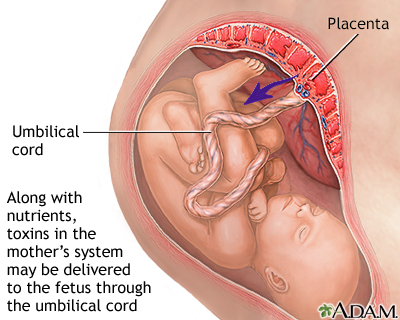 Substance use during pregnancy