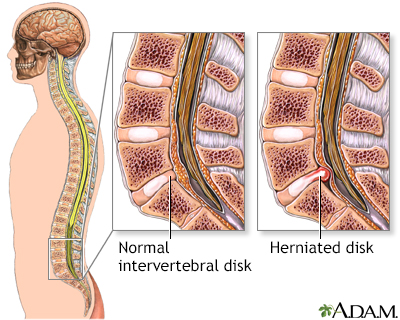 Normal anatomy